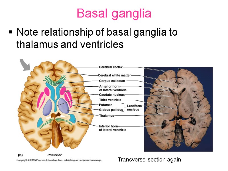 Basal ganglia Note relationship of basal ganglia to thalamus and ventricles Transverse section again